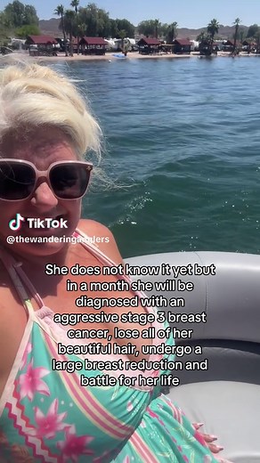 Navigating Breast Cancer: My Journey and Surgeries