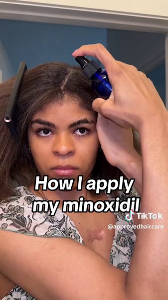 Effective Minoxidil Application Tips for Hair Growth