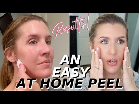 At Home Glycolic Acid Peel THAT WORKS! | Over 40 Skincare