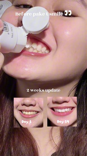 2 weeks pake Usmile Fresh White Camellia dan aku suka banget sensasi fresh-nya 🫧 Aromanya unik karena dibuat sama ahli parfum Swiss, jadi tiap sikat gigi rasanya seger tapi classy. Plus ini halal approved & made in Indonesia, cocok buat daily biar senyum makin pede ✨ @usmile Indonesia Official Shop #usmileid #freshwhite #repairwhite #usmileJadiLebihBaik