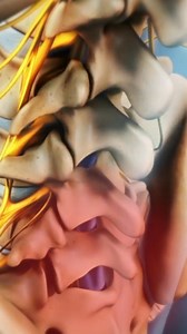 12K views · 64 reactions | Need to know why lumbar spinal fusion surgery is performed? 領 This video explains the main goals of spinal fusion, including stabilizing the spine, reducing chronic back pain, and improving mobility after injury or degeneration. Learn how this surgery can help treat conditions like herniated discs, spinal stenosis, and spondylolisthesis.  #SpinalFusion #BackPainRelief #LumbarSpine #SpineSurgery #ChronicPain #SpinalHealth #herniateddisc | Spine-health | Facebook