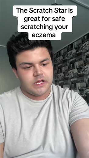 Scratch Star for Eczema Relief: Safe and Soothing Solution