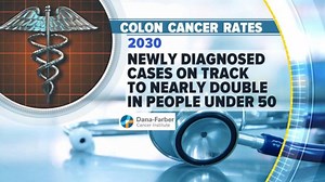45 is the new 50 when it comes to screening for colon cancer