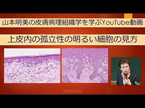 山本明美の皮膚病理解説動画 上皮内の孤立性の明るい細胞の見方