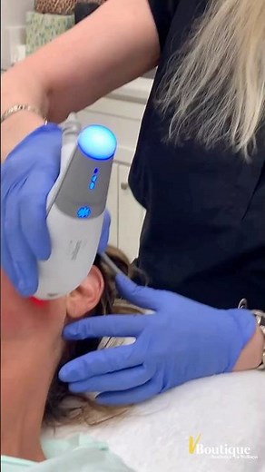 VBoutique - Dr V - BEFORE & AFTER of a Clear + Brilliant® TOUCH laser treatment!