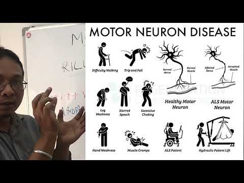 motor neurone disease:amyotrophic lateral sclerosis