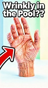 Why Do Your Fingers Actually Prune? 🤔