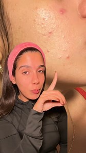 ✨ Discover the Power of Blue Light! ✨ Did you know that blue light...