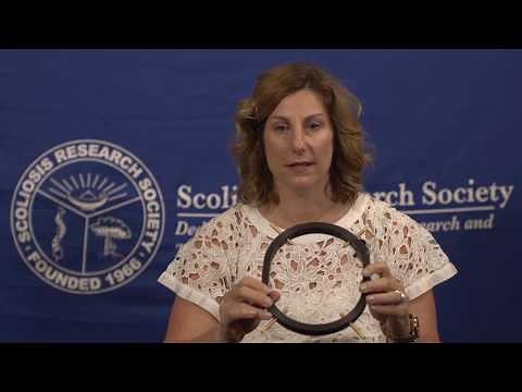 SRS Patient Video: Halo Gravity Traction - Amy McIntosh, MD