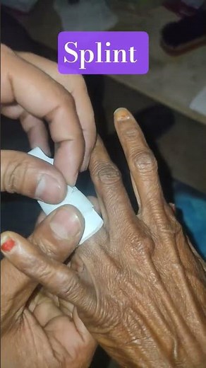 🏥How to apply a splint🩺🥼 #doctor #hospital #medical #nursing #shorts #trending #youtubeshorts