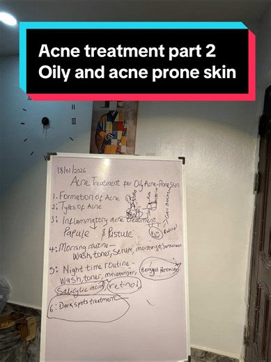 Effective Acne Treatment for Oily Skin