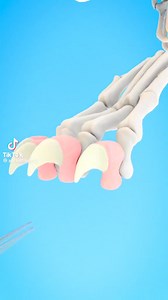 This is a great description of what a declaw procedure is and how it affects cats! We are adamant about not declawing our feline friends!! 🐾 | Safe Animal Shelter