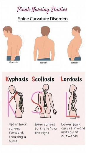 Spinal curvature disorders | Scoliosis | Lordosis | Kyphosis