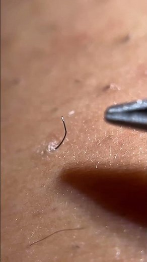 Plucking satisfying 😳