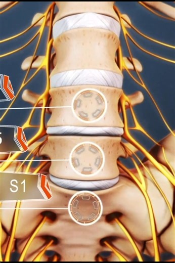 29K views · 239 reactions | Do you know what is causing your sciatica pain? | Spine-health | Facebook
