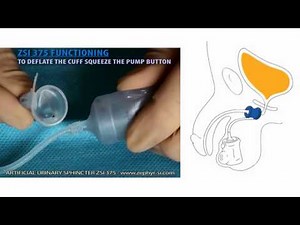 Artificial Urinary Sphincter FUNCTIONING, treatment for male severe incontinence