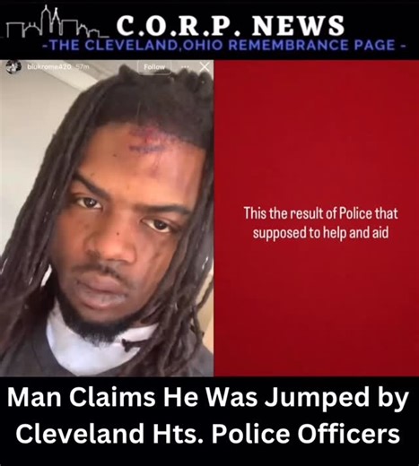CLEVELAND HTS — Man Alleges Brutal Beating by Police Officers A man claims he was violently beaten by multiple police officers in Cleveland before being issued two tickets and told to go home. According to the man, officers repeatedly punched, kicked, and stomped on his back during the incident. He alleges the encounter left him with significant injuries. Video obtained shows visible bruising on the man’s face and what appears to be a missing front tooth. At this time, it is unclear what led to 