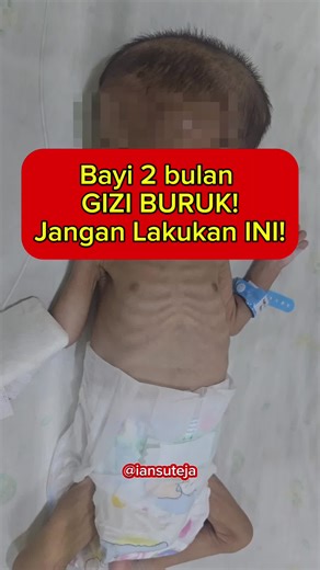 Tolong Jangan Lakukan INI ⚠️ Bapak Ibu kalau sedang berkonsultasi ke dokter anak, mohon memberikan informasi yang betul2 terjadi pada anak anda ya. Sering kok saya temukan orang tua yang mengatakan hal2 yang tidak masuk akan untuk menutupi keadaan rumah tangganya. Jika anda berbohong, tentu dokter tidak bisa memberikan anjuran/ terapi terbaik utk anak anda. Sampaikanlah hal yang sesungguhnya terjadi. Jangan malu, jangan takut dimarahin, jangan mengada2. Semoga tdk ada lagi kasus seperti ini. Say