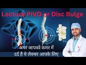 prolapsed disc treatment, bulging disc symptoms, herniated disc vs bulgin, ‪@drgautamphysiotherapy‬
