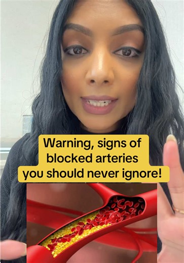 Warning Signs of Blocked Arteries You Should Never Ignore! #hearthealth #cholesterol Comment “yes” if you want to know the solution.