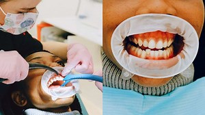 5 most neglected dental conditions and how they can be corrected with latest in dentistry