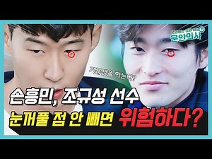 Could the moles on Son Heung-min and Cho Gue-sung's eyes be dangerous? | Eyelid Moles
