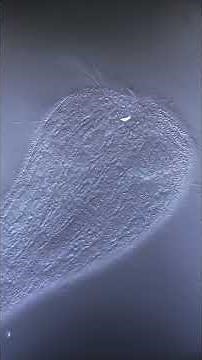 Blepharisma sp #microscope