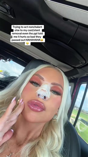 Preparing for My Cast Removal: The Anticipation and Humor