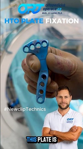 HTO Surgery: How a Plate Holds the Correction in Place 🦴⚙️