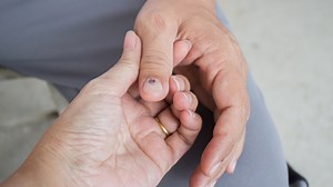 Hematoma, melanoma y onicomicosis: Cómo saber si las manchas de tus uñas son peligrosas