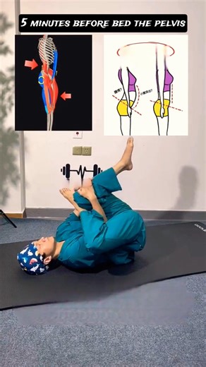 Fix Anterior Pelvic Tilt Fast with These Easy Moves 🔥 #PostureFix #CoreWorkout #HomeWorkout