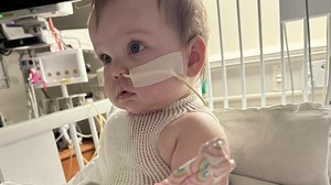 Baby girl recovering after getting severe burns at Concord day care