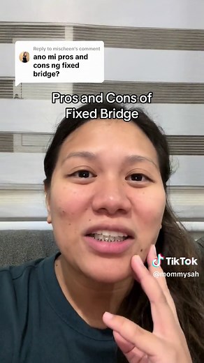 Pros and Cons of Fixed Bridge - Discover the Benefits and Considerations