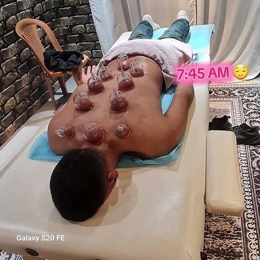 7:45 AM 🕒بداية يوم مليئة بالراحة مع الحجامة النبوية.. شعور التجدد لا يوصف. 🌱✨"