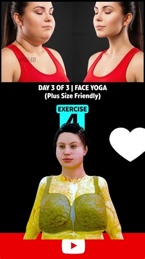 Day 3 - Double Chin Fat & Face Lift-P2