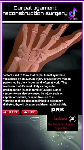 Carpal ligament reconstruction surgery