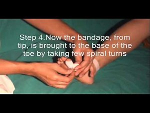 Great Toe Bandage