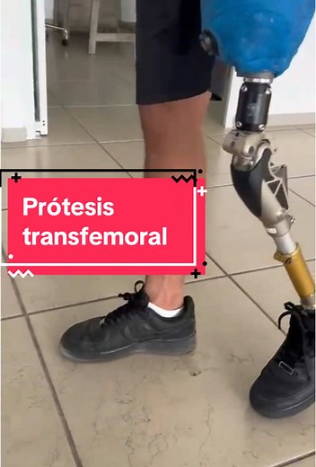 Cómo hacer una prótesis transfemoral paso a paso