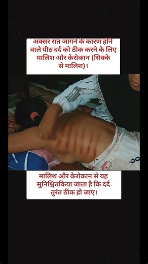 Massage and traditional scraping #Massage #TraditionalMassage #Kerokan #Video #Shorts #youtubeshorts