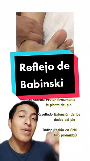 ...⚕️ Signo de Babinski ⚕️... . . ⚕️... . . #neurologia #babinski #reflejodebabinski #semiologia #tipsmedicos #estudiantedemedicina #medicina