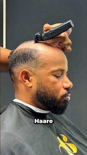 Von Glatze zu vollem Haar in Minuten!