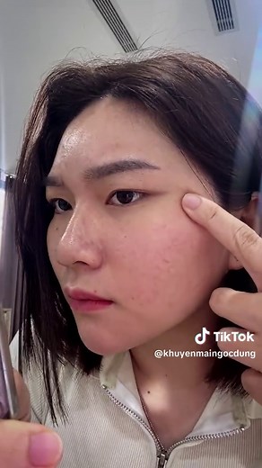Cách se khít lỗ chân lông hiệu quả với Laser CO2