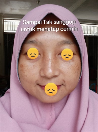 Mengatasi Flek Hitam dengan Tinted Sunscreen