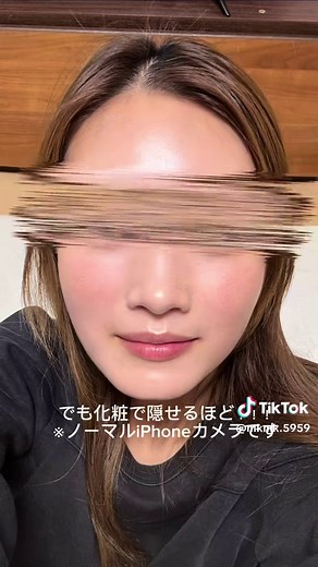 接触性皮膚炎の治療法とケア