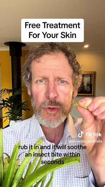 Aloe Vera for Insect Bites: Natural Relief Tips