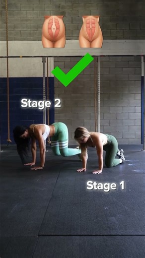 The 3 Stages of Diastasis Recti Healing Every Mom Must Know