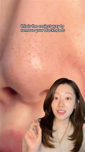 Easiest way to remove blackheads for teenagers & sensitive skin✨