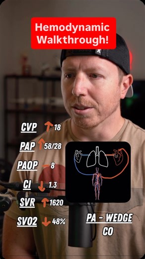NurseDosePodcast on Instagram: "HEMODYNAMIC WALKTHROUGH What are your thoughts? Anything you’d add or maybe think about differently? . Check out the ICU STARTER BUNDLE and the other Nurse Dose Cheat Sheets/Resources in the bio! . Follow for more ICU nursing education! 🎓 . #cvicu #cardiacnurse #criticalcare #nursingschool #icunurse"