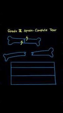 D236 OA – The One Concept You Must Grasp