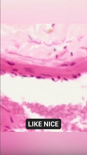 Where Tunica Intima is located | Vein under the microscope
